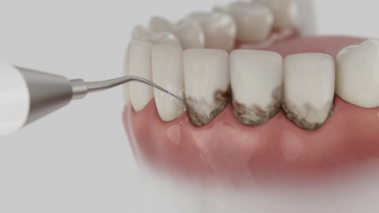 Reliable Emergency Dentist contractor in Comer, GA by Smile Center Dentistry